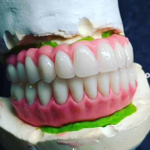 Laboral-Próteses-Dentárias