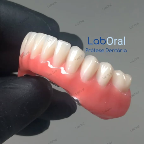 Laboral-Próteses-Dentárias