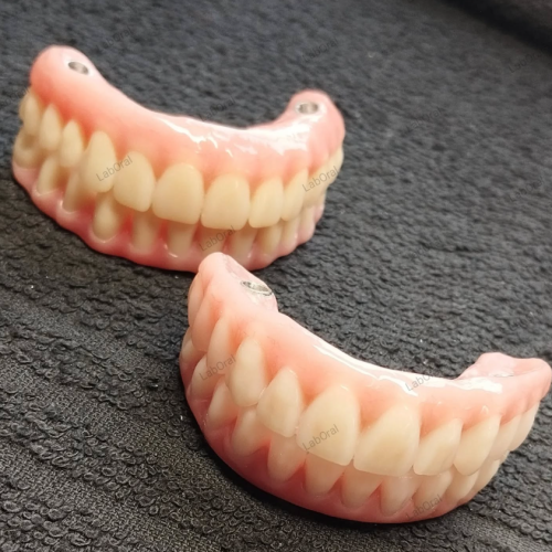 Laboral-Próteses-Dentárias